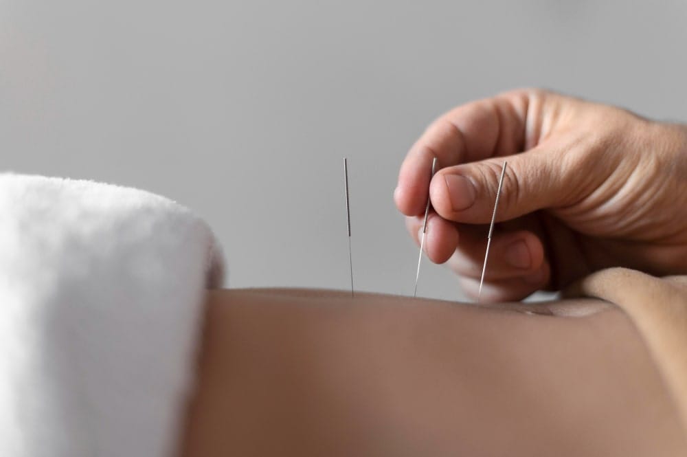 acupuncture pricing