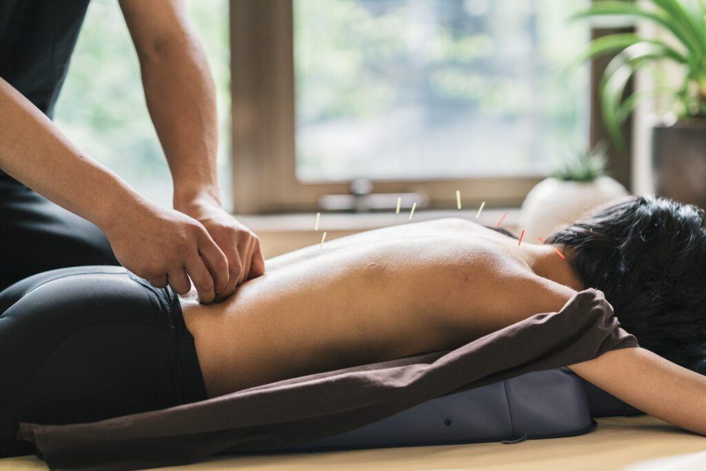 Therapist Giving Cupping Treatment To Young Asian Woman