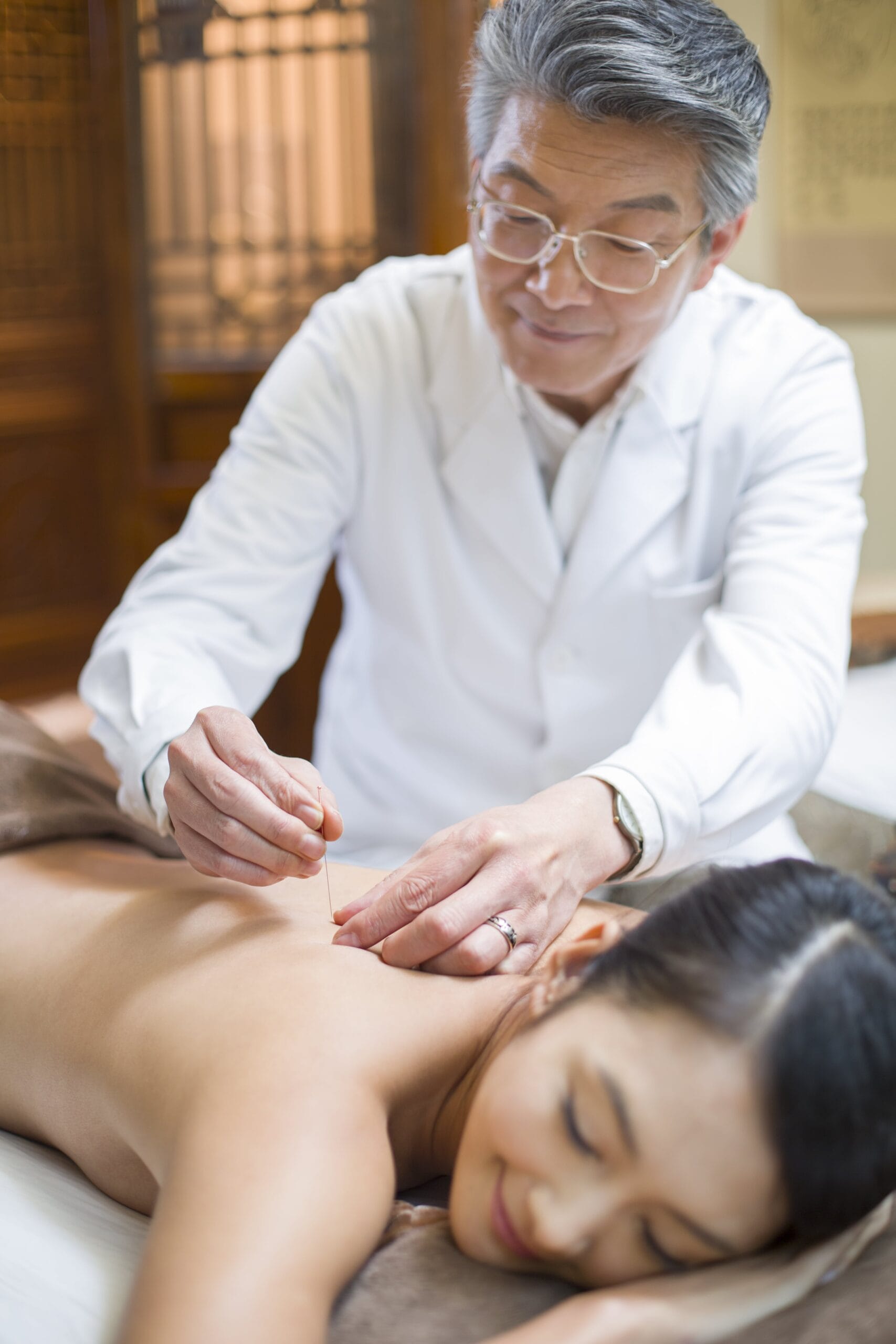 young woman receiving acupuncture min